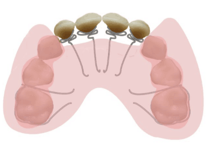 大连齿医生口腔科普地包天矫正要趁早最佳治疗时间是什么