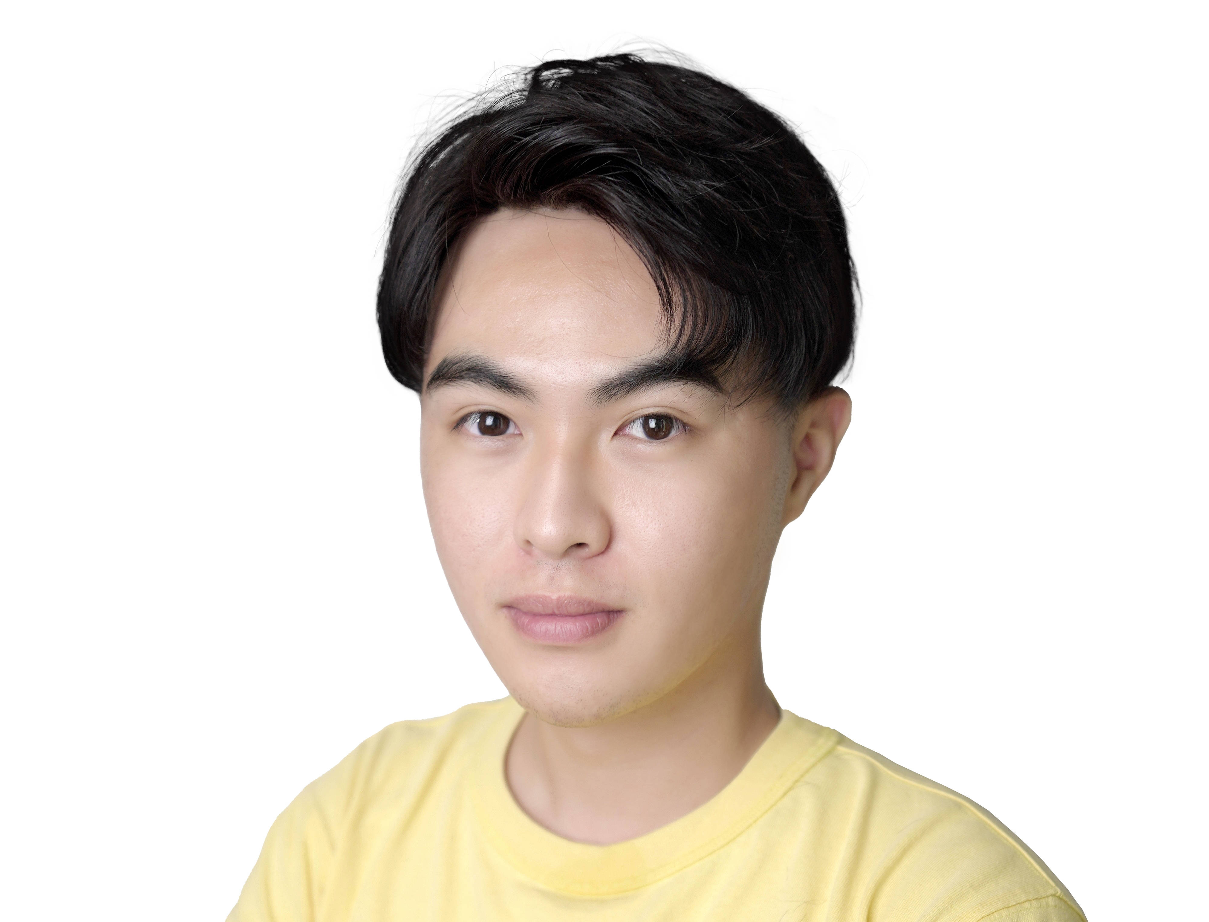 小伙子长得挺俊的,就是"英年脱发"了!