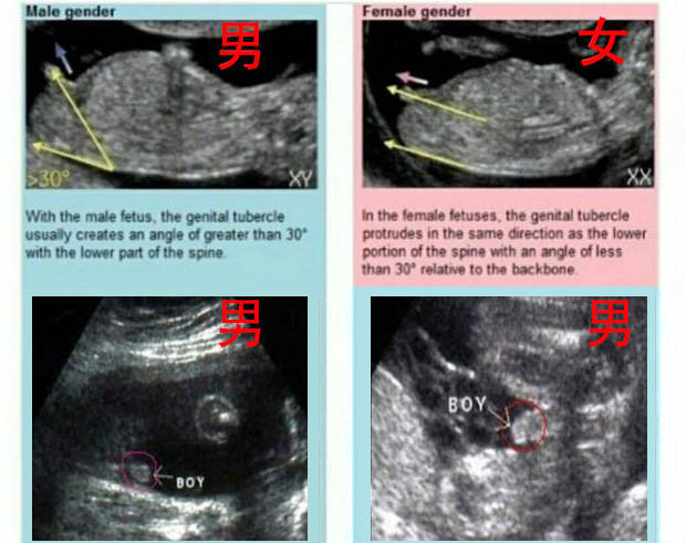 十二周胎儿图片