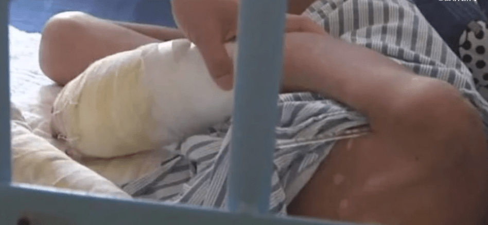 原创7岁男童被父亲虐待到面临截肢有些人自愿不育就是造福了
