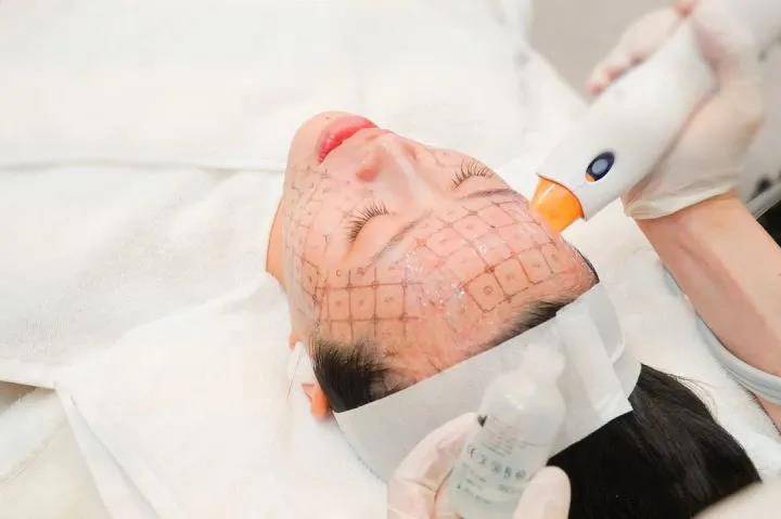 收好热玛吉这份攻略,抗衰不踩坑!