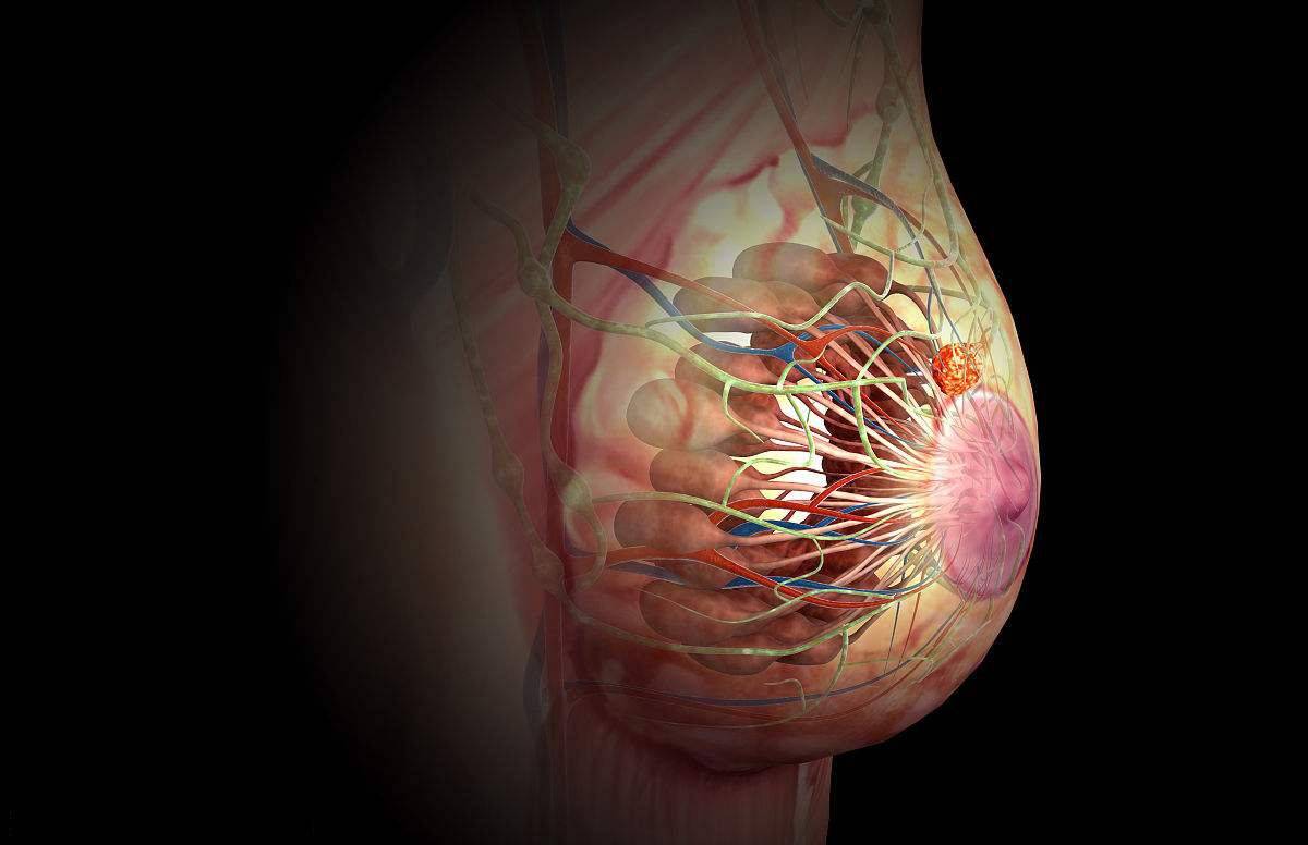 【疾病科普】乳腺癌患者抑郁率高达50%