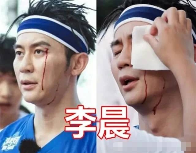 杨颖手骨折,张艺兴晕倒,看到最后:心痛!