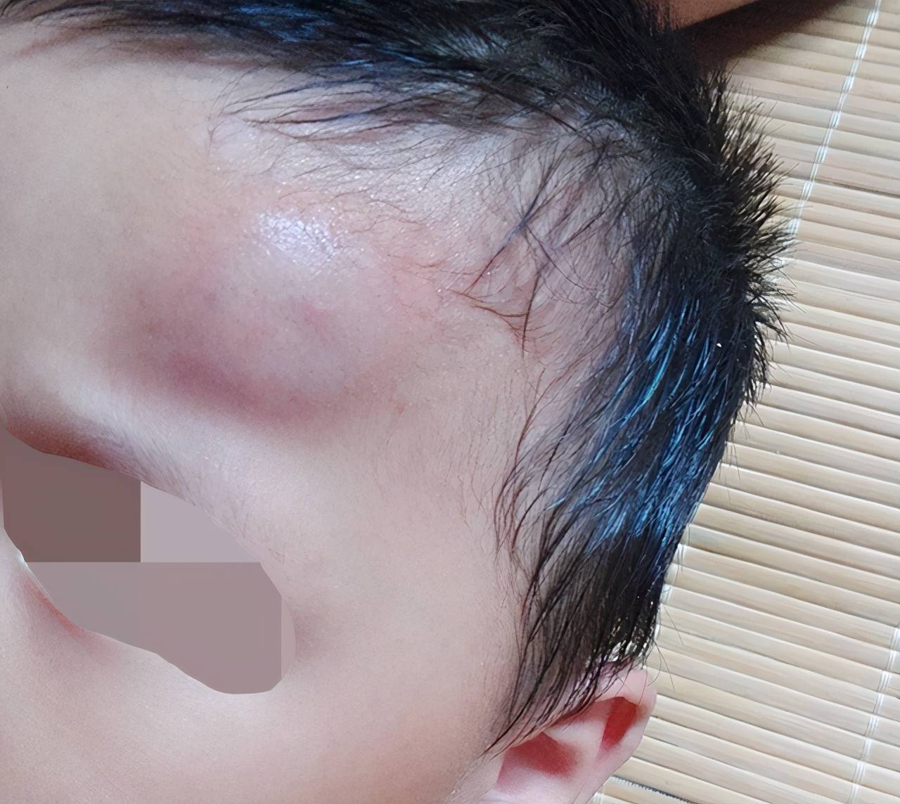 宝宝掉床后,明智的父母不会立马扶,了解"黄金十秒"很重要_头部