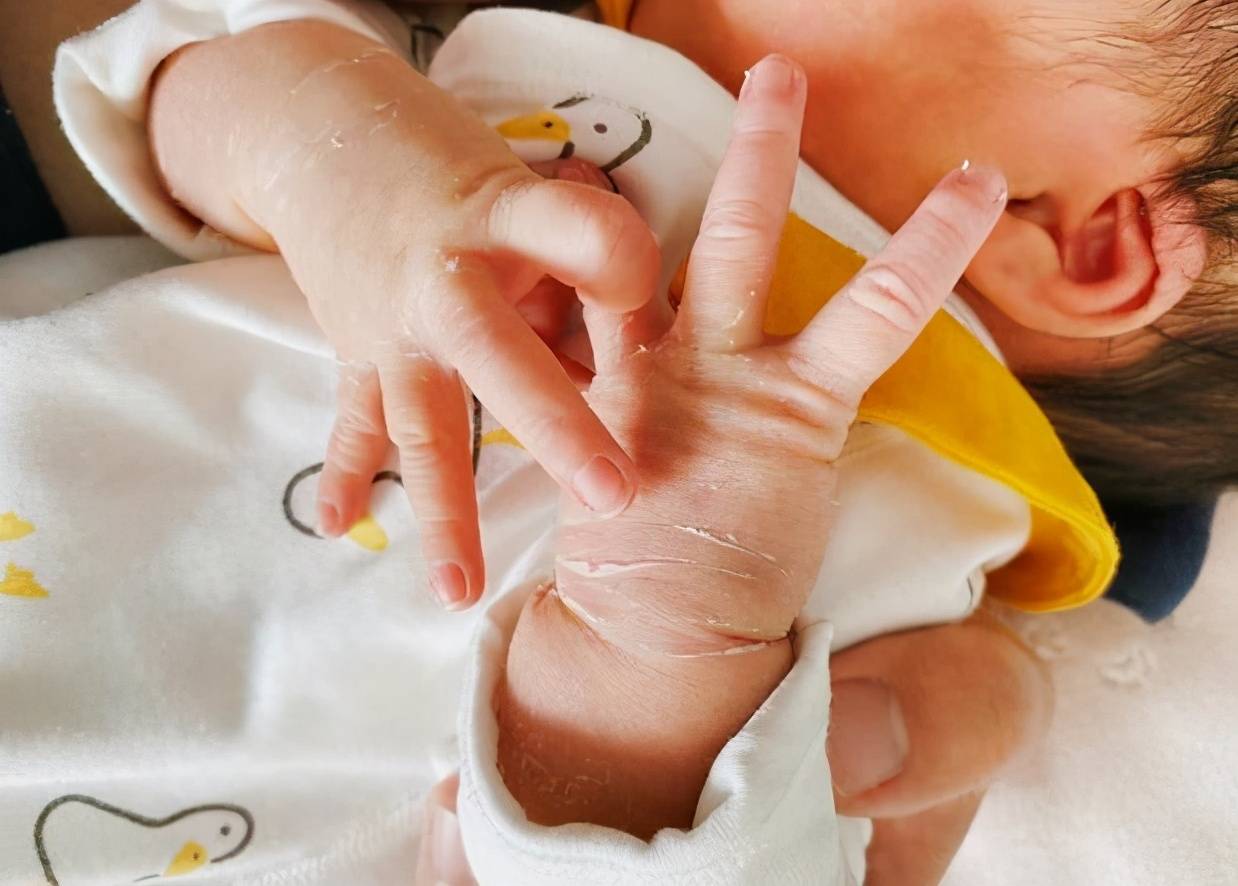 新生宝宝的9个"秘密",医生懒得告诉你,但家长一定要知道