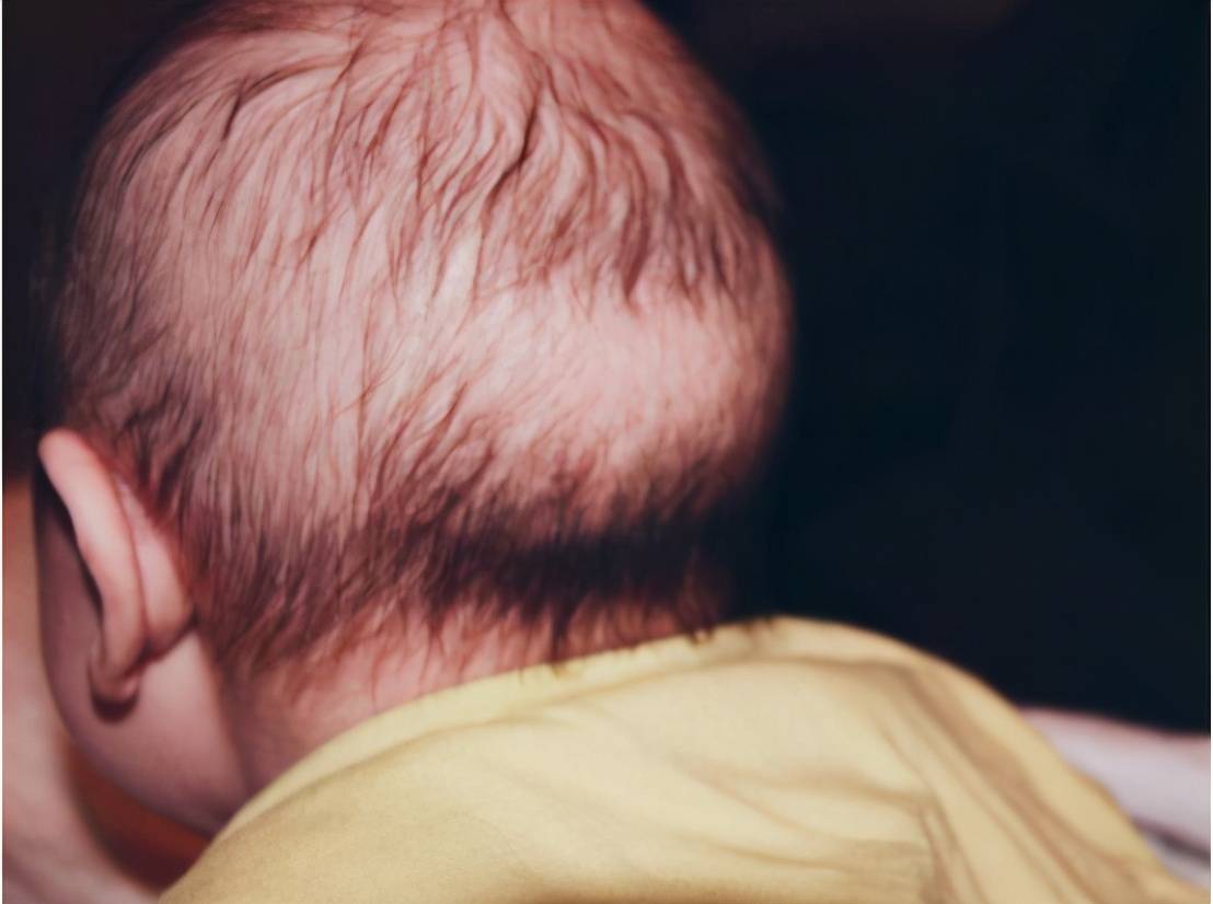 8个月婴儿发型男图片
