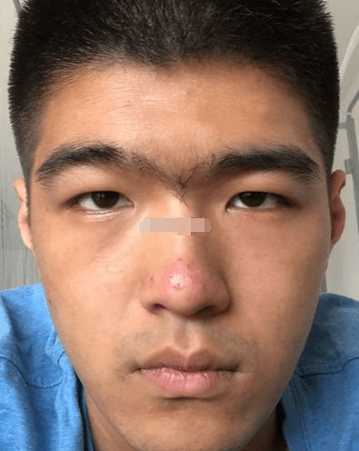 你的眉毛粗浓而且是连心眉,脾气不是很好,比较的倔强, 过于执着,不