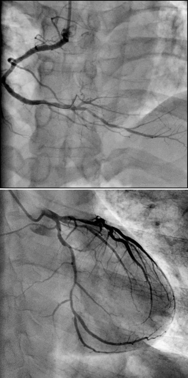 极光平板dsa的showtime