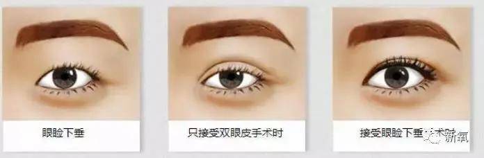 自带情绪个性的三白眼真的是每个时代美人的特别标志吗?_眼睛