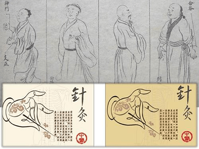 国之瑰宝针灸为何如此神奇