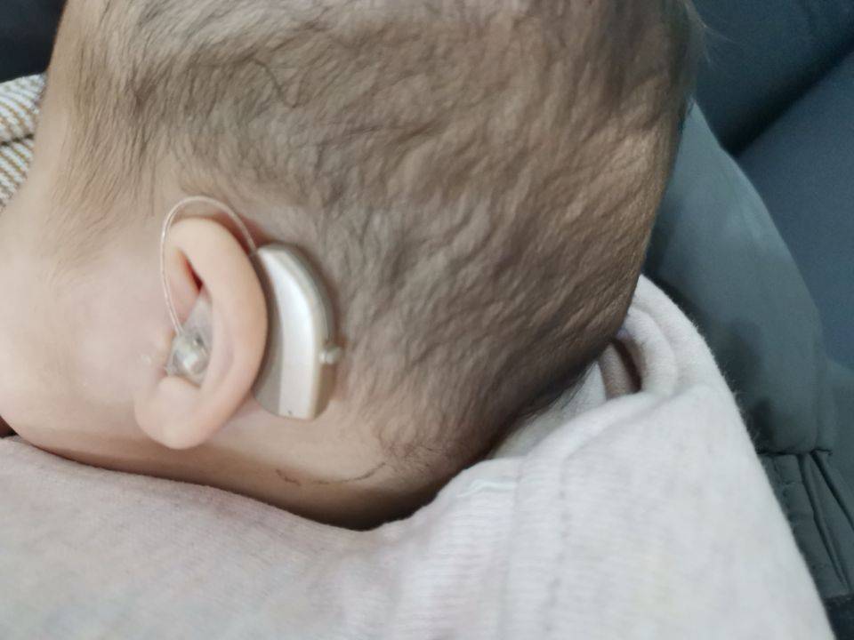 宝宝确诊听力不好我们该怎么做