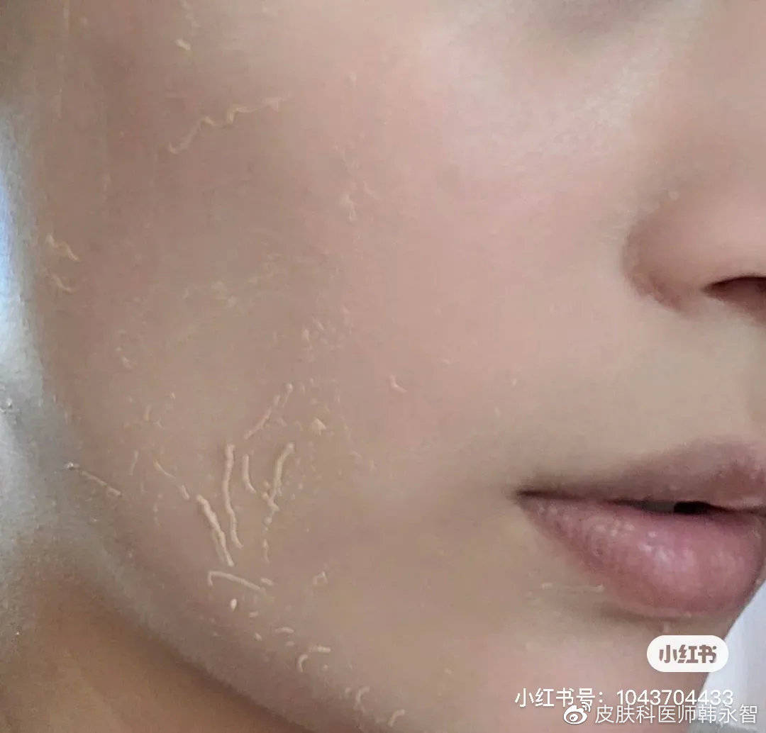 为什么别人都夸的护肤品,你用起来却搓泥?