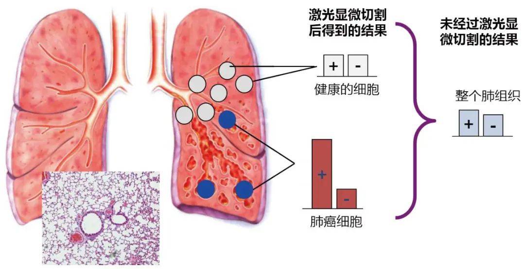 Lmd7000激光显微切割服务 Of