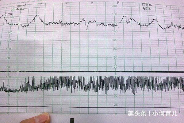 孕晚期胎心偏高怎么办