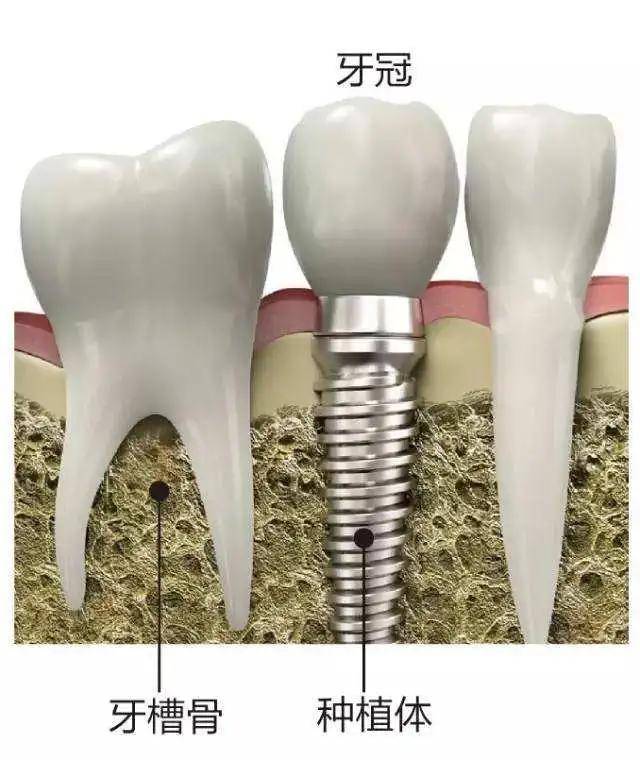 梦境的隐喻，问梦见牙齿掉了好是坏？