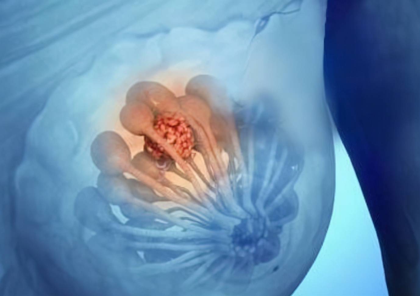 乳腺长了结节,请牢记"3不吃,2少做",别让病情加重