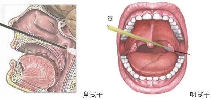 女肛拭子核酸检测图片