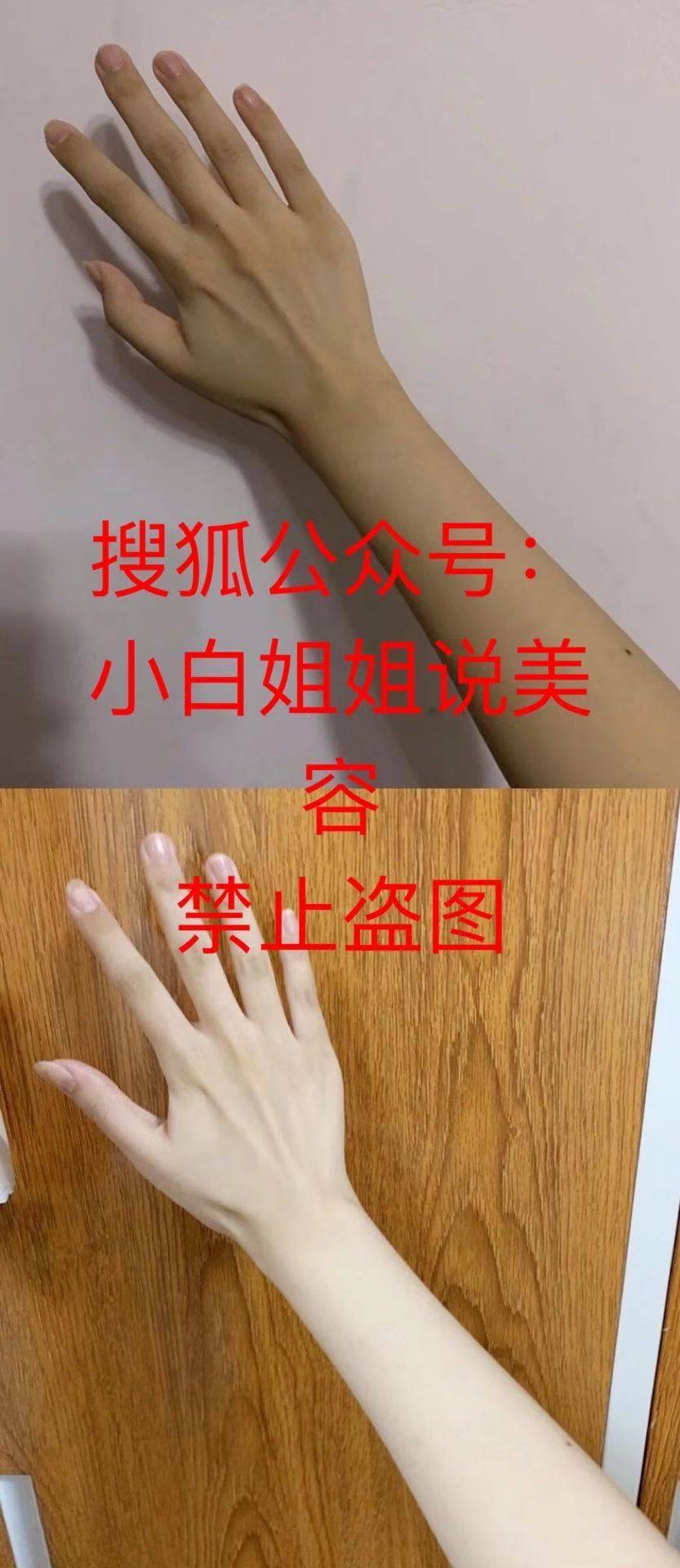 正品|日本铂金美白针为什么不适合天生黑的人？