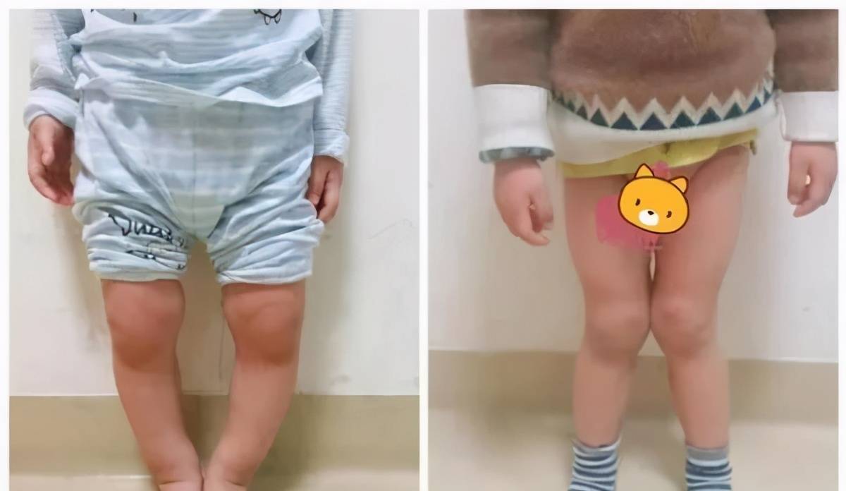 宝宝腿打开我进不去小说