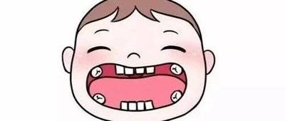 小朋友牙齿上的黑色素能去掉吗