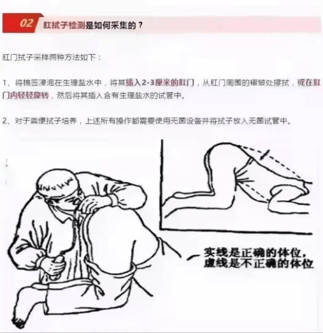 空仑提醒您肛拭子采集真的很有必要也很严肃