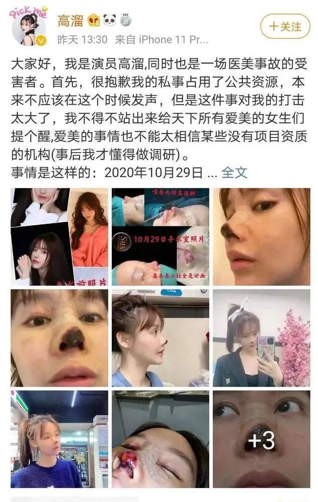 女演员自曝整形失败 广州熙施时光医疗一年内被