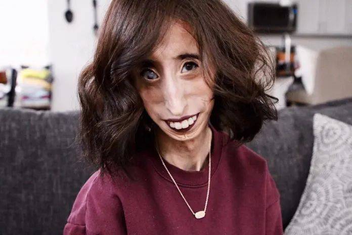她丑到被拿来吓唬孩子,却靠嘴巴逆袭成为世界级"网红"!