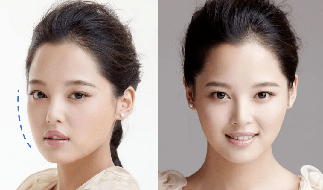 现实中高精度"佛像脸",辛芷蕾撞脸了!_五官