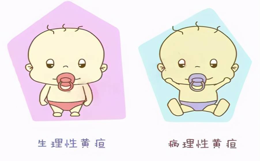 03新生儿黄疸的家庭护理要点