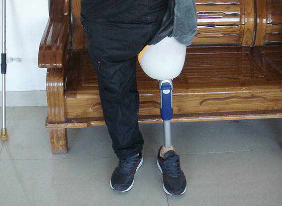 再就是假肢是越轻越好,所以重点来了,截肢患者选择大腿假肢最低标准