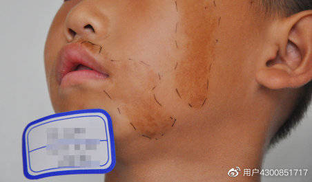 色素是怎样产生的 19e42ae15fd04ae893f3d8f701ba8032.jpeg