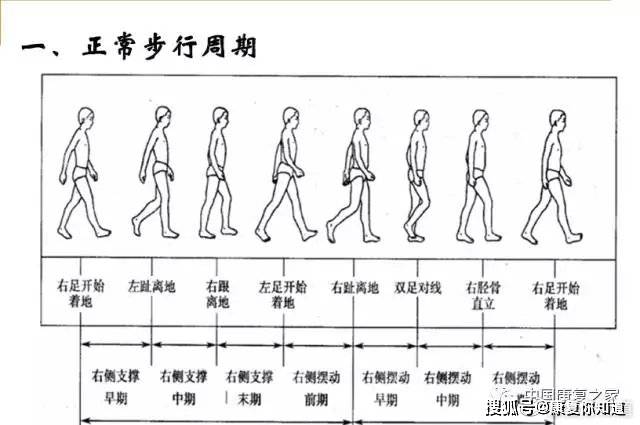 常见异常步态分析及矫治方法 患者