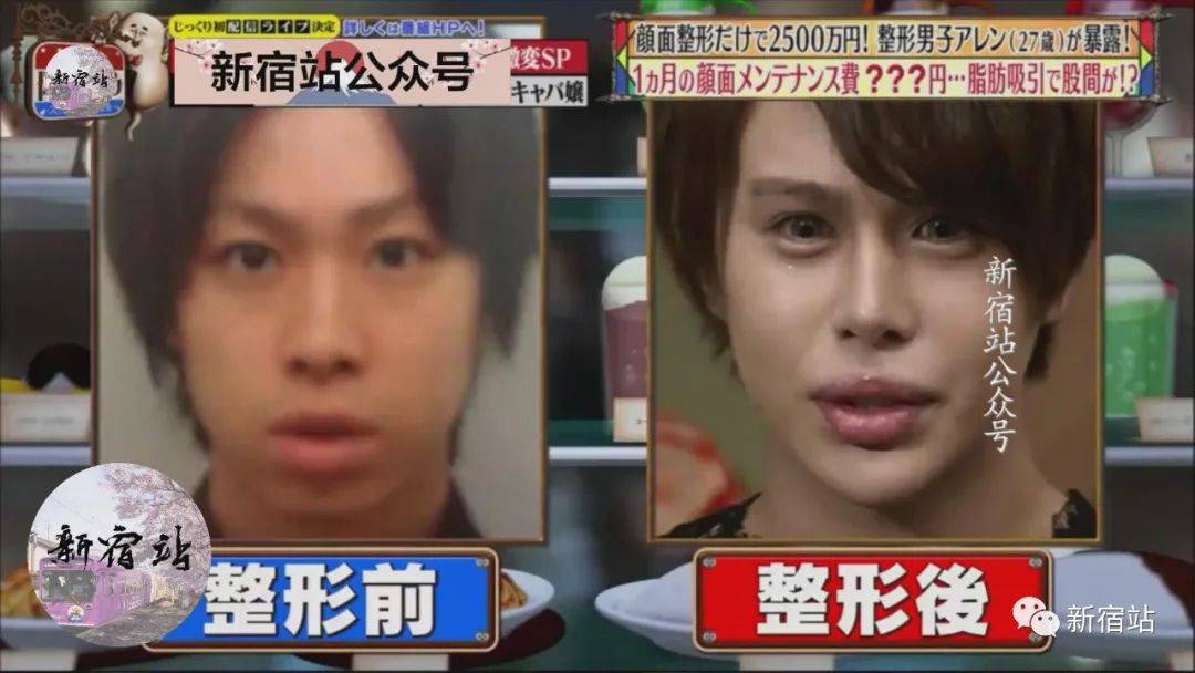 对脸部整形超100次的日本整形中毒男 难道越整越恶心说的就是这些吗 Aren