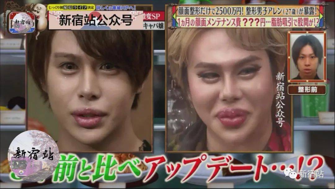 对脸部整形超100次的日本整形中毒男 难道越整越恶心说的就是这些吗 Aren
