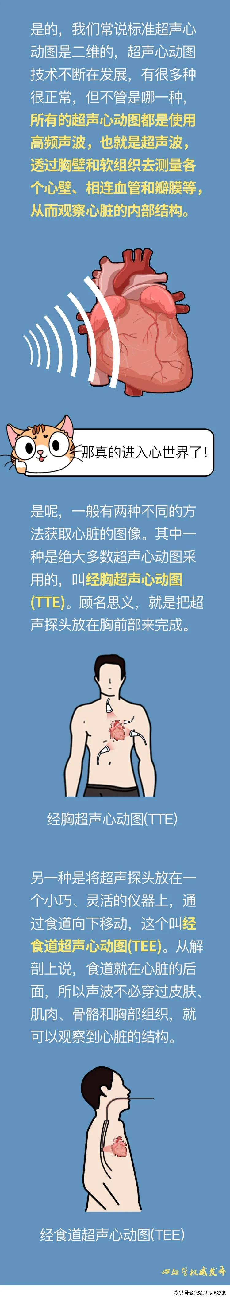 一次性搞懂超声心动图！_搜狐网
