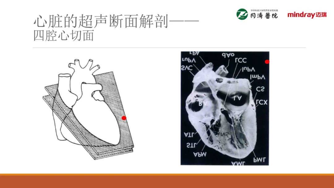 围术期经胸超声心动图tte