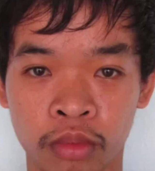 小伙长得丑处处碰壁怒花11万整成美男子连爸妈都认不出了