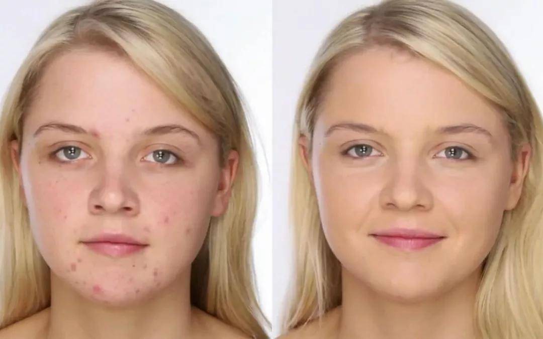 怎么护肤能让皮肤变得无瑕疵 162510b593b2477cbde57b0966e59c43.jpeg