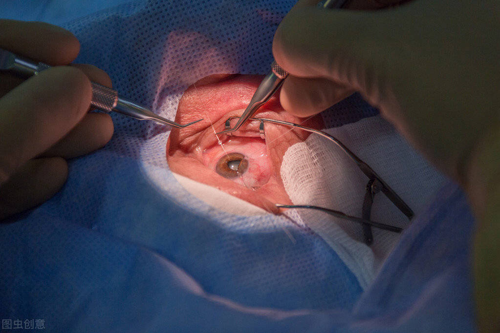 春暖花开白内障手术正当时