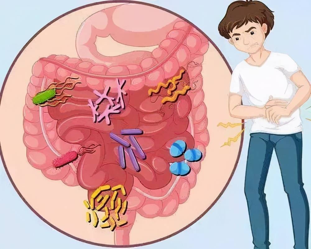 引起慢性结肠炎的原因有哪些该怎样治疗慢性结肠炎