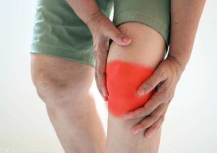 什么是滑膜炎什么症状 05564b657597463f93afc5853e179064.png