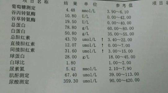 肝功能检查单看不懂不用担心我来教你看懂