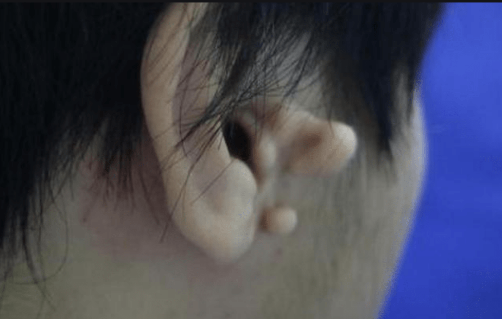 耳朵拴马桩图片