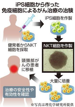 日本尖端医疗-千叶大学研究团队将ips制作的nkt移植给癌症患者_干细胞