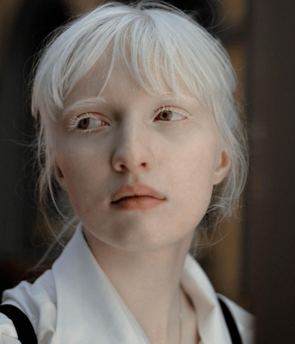 她被嘲"吸血鬼",21岁逆袭成超模,获网友大赞:天使路过人间!_nastya