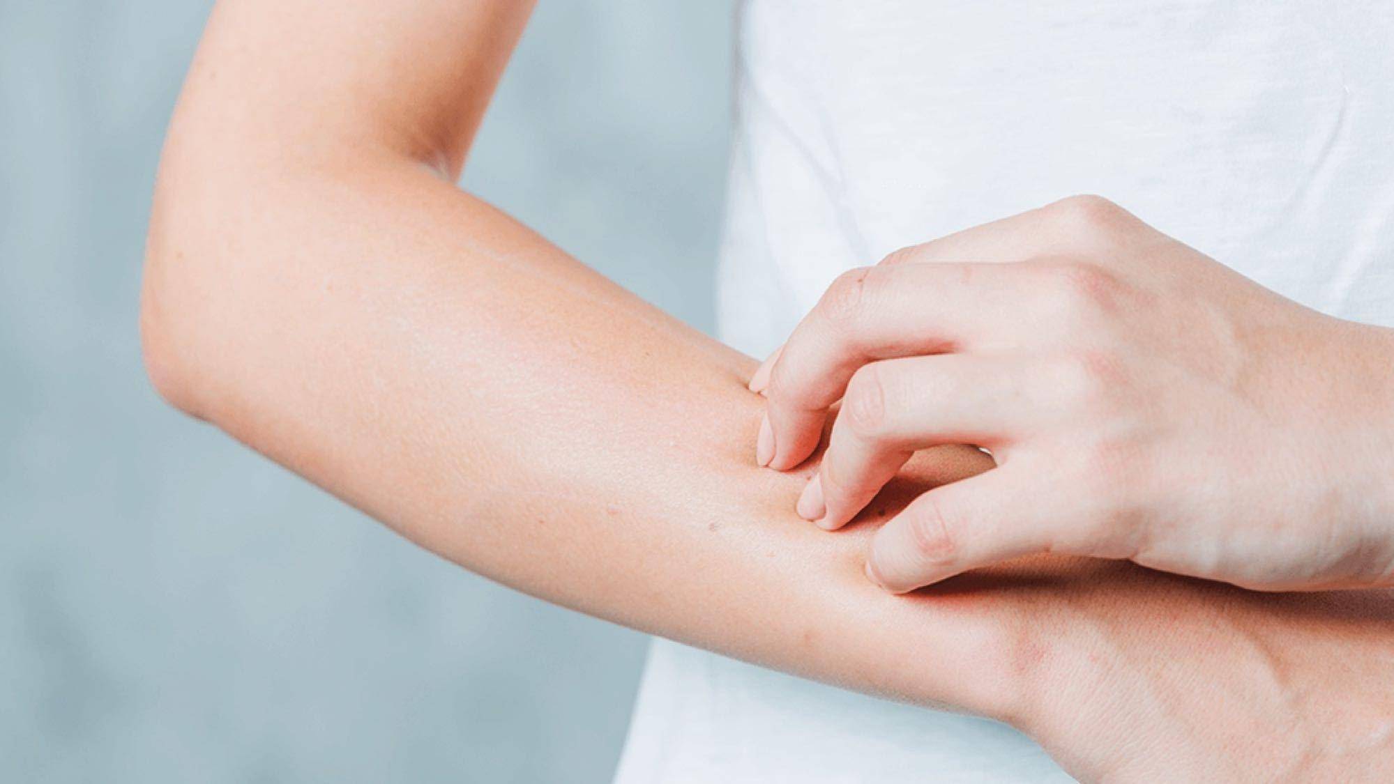 三伏天容易出现哪些皮肤问题?