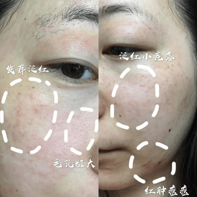 6c11f1395fda4839a7d9d0872f680d36.png