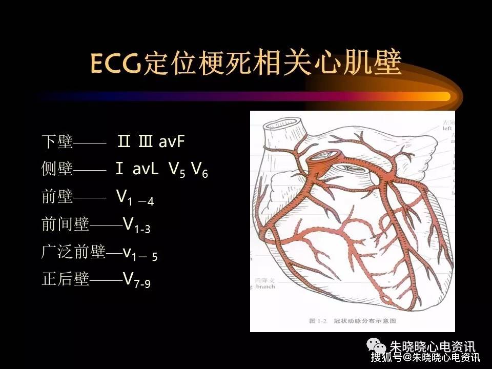 急性心肌梗死的診斷及治療