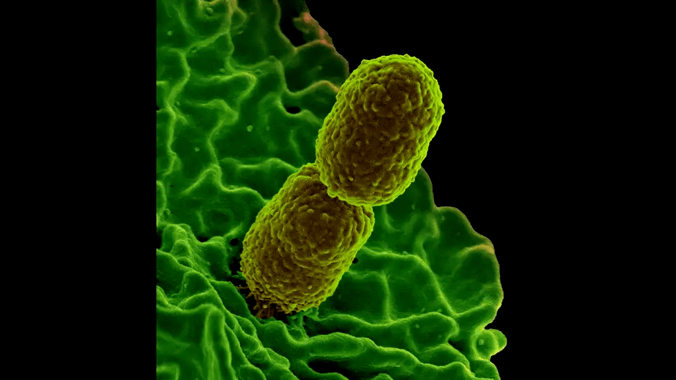 用作 生物武器 的细菌长啥样 多张图像揭秘致病菌 上图