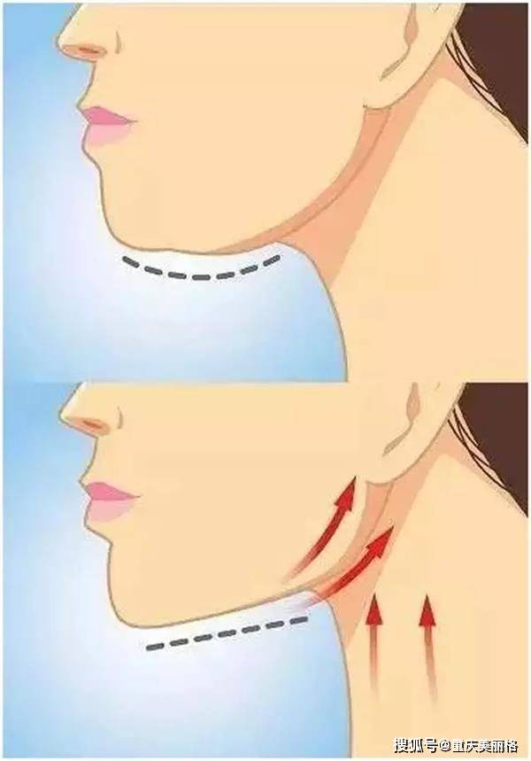 怎么拥有好看的下颌线 eb78d83d1fda45f19f802317b45d35a1.jpeg